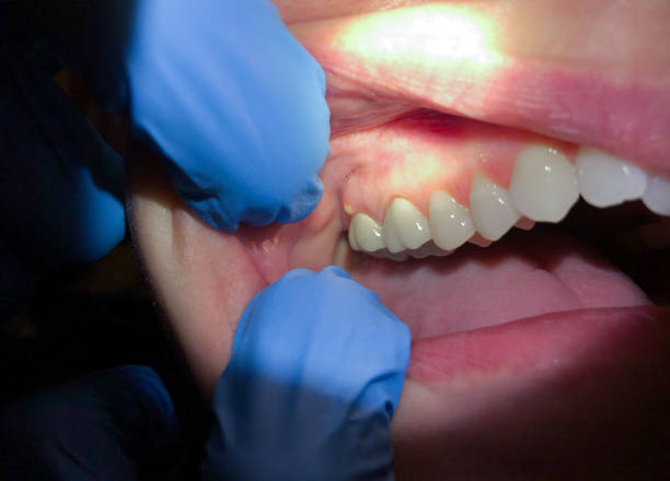 Best Cracked Tooth Emergency Dentist  in Edmond, OK